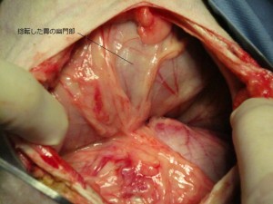 術中胃２