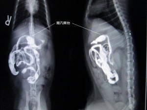 バリウム２時間後2