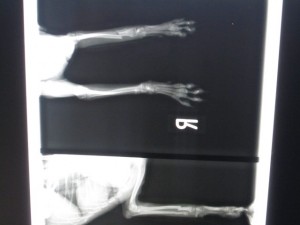 ピンニング術前